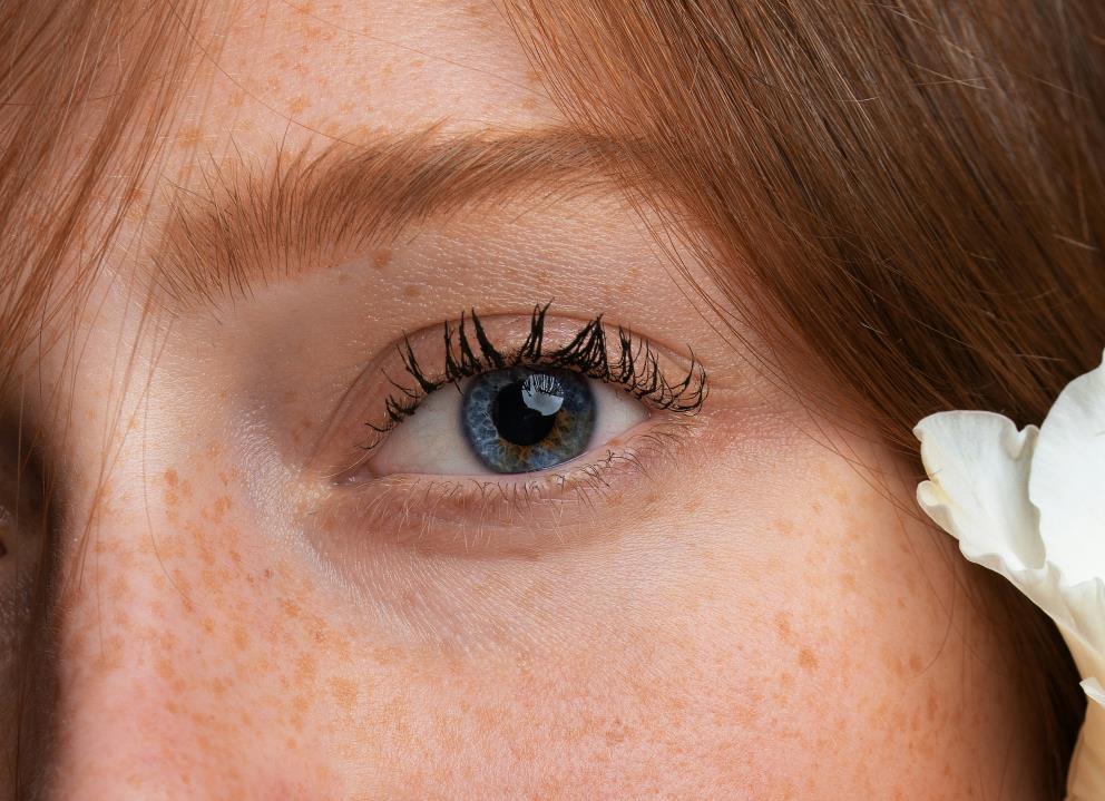 Tratamiento: Plasmage. Una alternativa no quirúrgica a la blefaroplastia