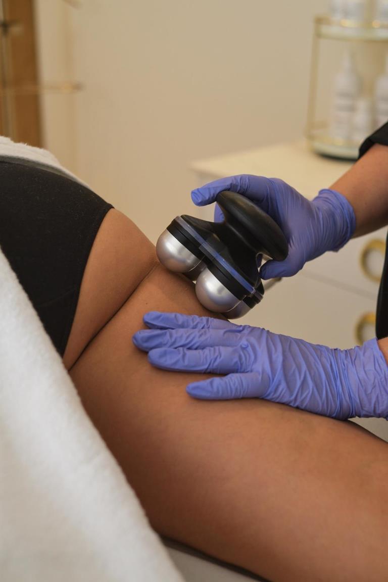 Radiofrecuencia cuatripolar focalizada y remodelación corporal